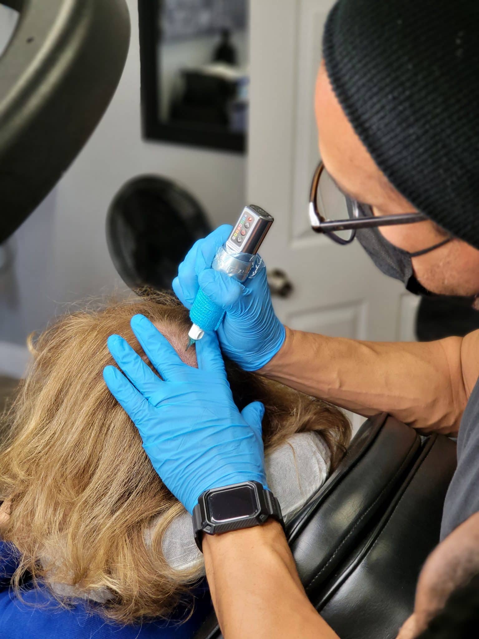 Scalp Micropigmentation for Scars Doctor Working on Patient